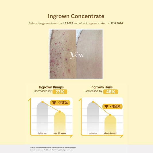 Ingrown Concentrate Oil Roller Ball